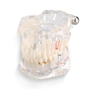 Cocoarm dental care model removable tooth model doctor dental demo implant dentist teaching study model transparent teaching tool for dentist demonstration - product information 22