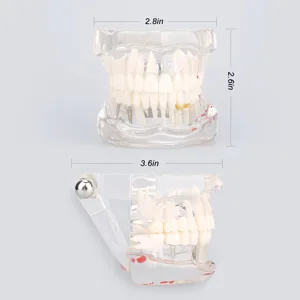 Cocoarm dental care model removable tooth model doctor dental demo implant dentist teaching study model transparent teaching tool for dentist demonstration - product information 23