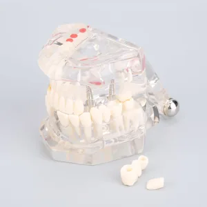 Cocoarm dental care model removable tooth model doctor dental demo implant dentist teaching study model transparent teaching tool for dentist demonstration - product information 25