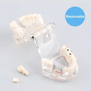 Cocoarm dental care model removable tooth model doctor dental demo implant dentist teaching study model transparent teaching tool for dentist demonstration - product information 26