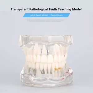 Cocoarm dental care model removable tooth model doctor dental demo implant dentist teaching study model transparent teaching tool for dentist demonstration - product information 27