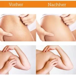 Vitabay Stretch Mark Cream 100 ml Special care to prevent and reduce stretch marks - stretch mark