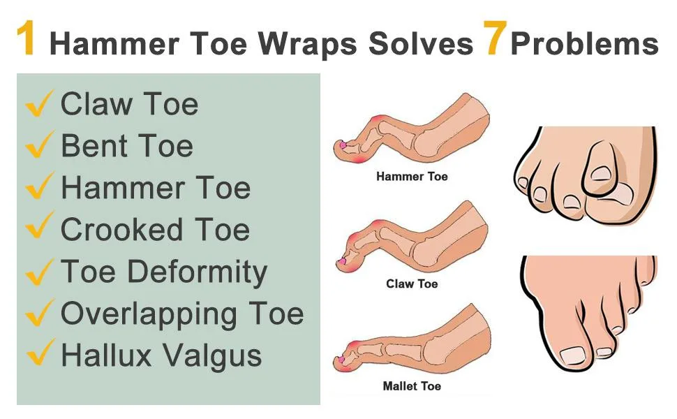 Welnove toe spreader hammer toe corrors hammer toe foot pad for hammer toe claw toe corrators -2 pieces (3 holes) 3 loop toe straightener *1 pair - product information 9