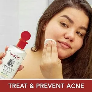 THAYERS Lemon Oil Control Blemish Stick, 0.23 Ounce THAYERS Oil Control Blemish Stick, 0.15 Oz, Lemon, 0.23 Oz - Section4