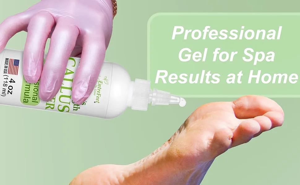 Dr. Entre's Callus Remover Gel: Extra Strength Callus Remover for Feet, Foot Callus Remover, Foot Care, Pedicure Tools Supplies, Dead Skin Remover, 4 oz - callus remover for feet