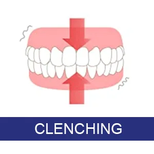 ASRL Mouth Guard for Clenching Teeth at Night, Night Guards for Teeth Grinding (4 Pack, 2 Sizes) - Clenching