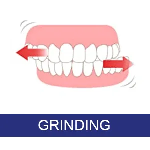 ASRL Mouth Guard for Clenching Teeth at Night, Night Guards for Teeth Grinding (4 Pack, 2 Sizes) - Grinding