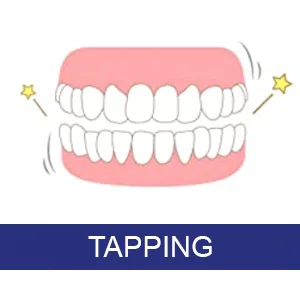ASRL Mouth Guard for Clenching Teeth at Night, Night Guards for Teeth Grinding (4 Pack, 2 Sizes) - Tapping
