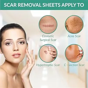Silicone Scar Removal Sheets, Washable Scar Strip Remover, Reusable Scar Sheet for Surgery Scars, Stretch Marks, Burns, Keloids, C-Section, Acne in Recent/Old Scars - product information 5