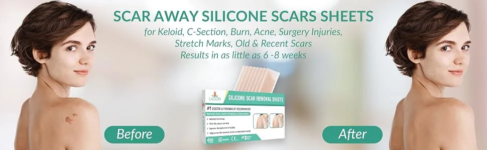 Silicone Scar Removal Sheets, Washable Scar Strip Remover, Reusable Scar Sheet for Surgery Scars, Stretch Marks, Burns, Keloids, C-Section, Acne in Recent/Old Scars - scar away silicone scar sheets