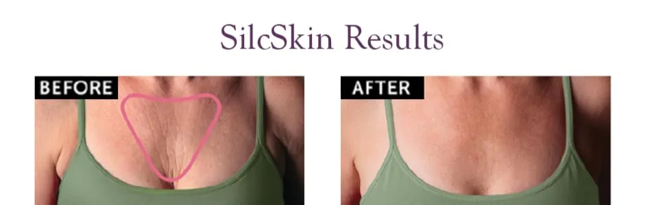 SilcSkin Decollette Pad to Correct & Prevent Chest Wrinkles from Sun, Aging, Side Sleeping, Reusable Self Adhesive Medical Grade Silicone, 2 Pads SilcSkin Decollette Pad, 2 pad - Decollete Pad, anti wrinkle silicone skin patch, anti wrinkle patches, anti wrinkle chest pads