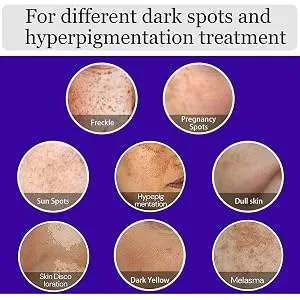 Dark Spot Remover for Face Hyperpigmentation Treatment. Dark Spots, Melasma, Freckle, Sun Spots Removal Dark Spot Corrector Cream for Women and Men - product information 4