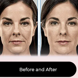 Face Moisturizer 2,5% Organic Retinol Cream with Hyaluronic Acid - Anti Aging, Wrinkles & Fine Lines - ESTETIST