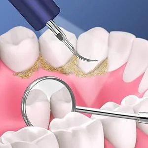Teeth Cleaning Kit with LED Light, 4 Replaceable Heads & Oral Mirror, 3 Modes Dental Care Teeth Cleaner, Home whitening Tools Safe Navy blue - teeth care