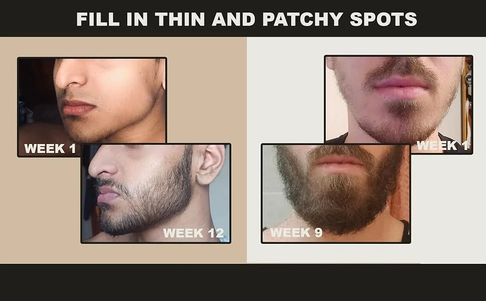 Crafted Beard Growth Kit - The Best Beard Growth Kit - Grow A Thicker Fuller Beard - 3x Beard Growth Oil, 3x Beard Roller, 3x Beard Growth Vitamins (3 Month Kit) 9 Piece Set - FILL IN THIN AND PATCHY SPOTS