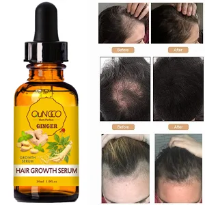 5 PACK Hair Growth Serum Liquid Hair Loss Treatment for Women & Men Dense Thicken Hair - 1654