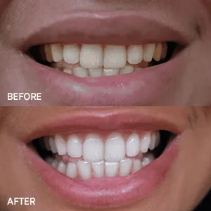 V34 Colour Corrector Teeth Toothpaste, Teeth Whitening Toothpaste Conceals Stains and Improves Teeth Brightness and Reduce Yellowing (Purple) - product information 4