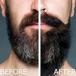 Arlo's 2-in-1 Beard Wash and Conditioner 12 oz. - Pro Growth Formula - before and after