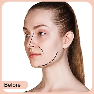86 Pieces Face Lifting Tapes with Lifting Rope Sets - product information 3