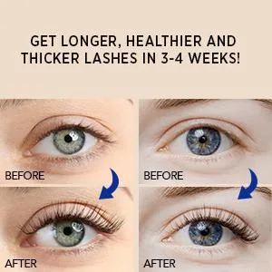 VigorWell Eyelash Growth Serum for Longer Thicker Lashes & Brows, Irritation Free Formula (5mL) - eyelash growth serum