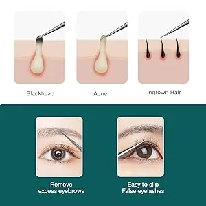 MR.GREEN Ingrown Hair Tweezers Needle Nose Pointed Tips Tweezers For Eyebrows Splinters Blackhead Removal Acne Clip Extractor (Long) - 2191-300-1