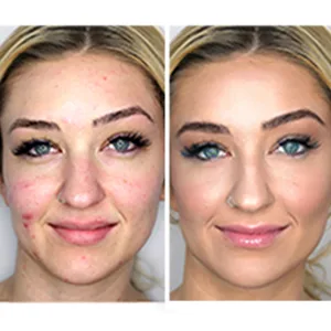Woosh Beauty The Fold Out Face with Secret Brush Medium Deep - buildable coverage, for all skin types, including acne, rosacea and melasma