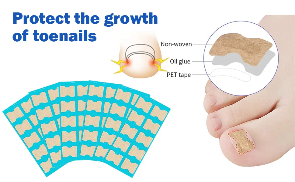 Toenail Corrector Patch, Ingrown Toe Nail Correction Sticker, Glue-Free Ingrown Toenail Corrector Strip, With Nail Correction Tool, 60PCS - product information 2