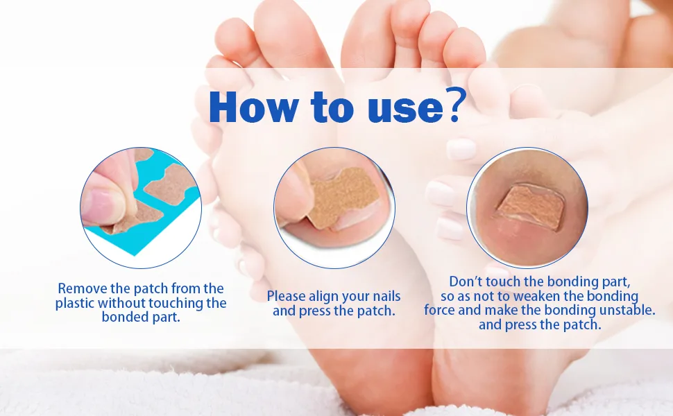 Toenail Corrector Patch, Ingrown Toe Nail Correction Sticker, Glue-Free Ingrown Toenail Corrector Strip, With Nail Correction Tool, 60PCS - product information 7