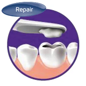 Dentek orabrush-tongue cleaner 6 Pack - Reparatur