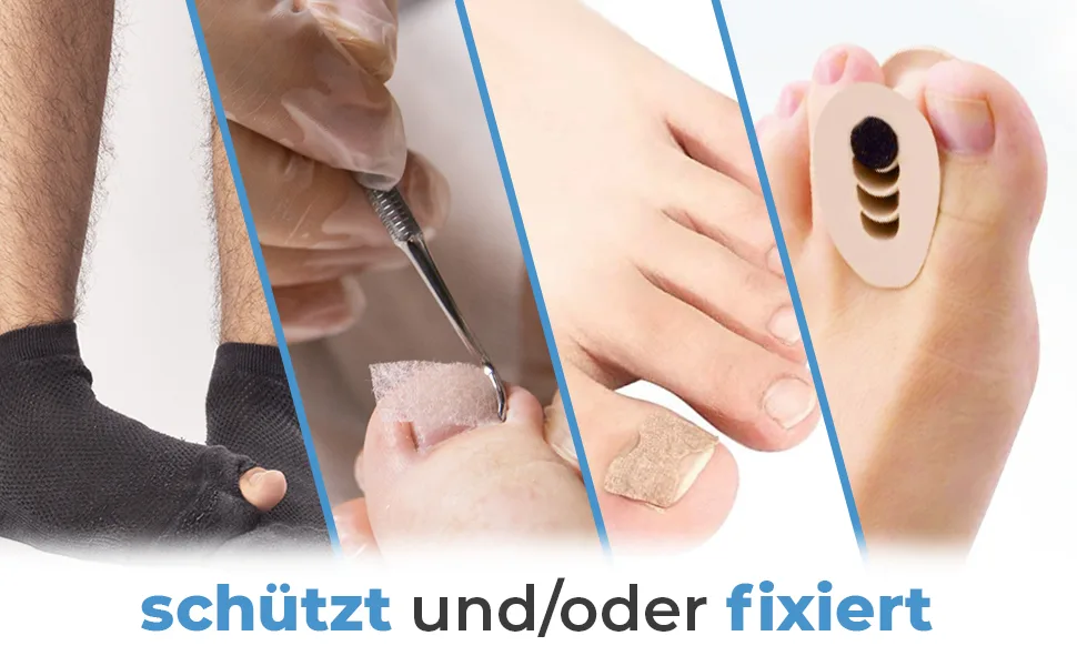 Toe bandage 2.5cm self-adhesive bandage for connecting fixing elastic cohesive Rinki quick bandage 1 pack 2.5cm - Fixierung, Schutz