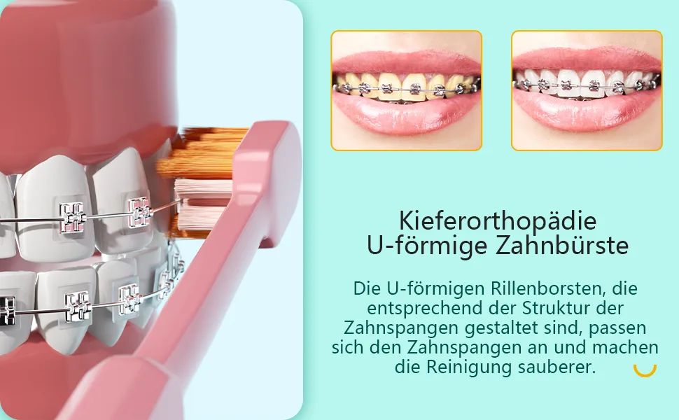 Y-kelin orthodontic toothbrush U-shaped soft brush head 4 pack each contains a toothbrush protection head - product information 4