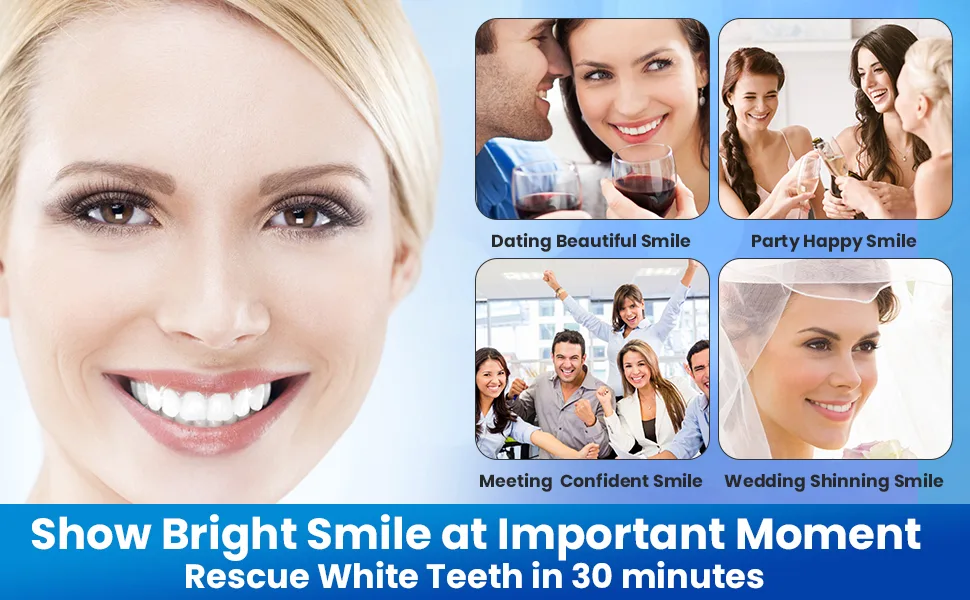 Tooth element strips whitening teeth white stripes teeth 56 whitening stripes - 28 whitening sessions safe for tooth enamel tooth bleaching stripes white teeth bleaching teeth 56 pieces (1 Pack) - teeth whitening strips