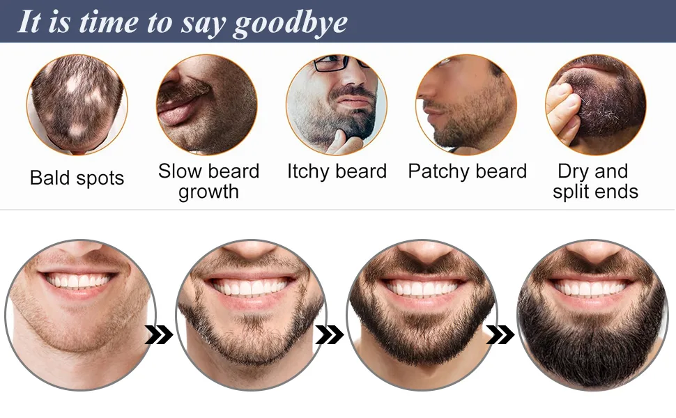 EBeizi beard growth set for men bare scooter with beard growth oil stimulates beard and hair growth 0.5 mm dermar roller for men amazing beard growth set 2 pieces (1 Pack) - Bald spots beard, itchy beard, patch beard