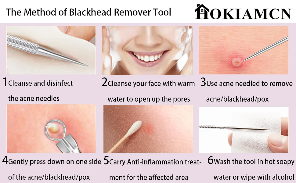 4 -pack remover remover comedone squeezer set Ellolife Blackhead Remover with box made of stainless steel acne white white shears remote kit for all skin types (silver) - DE4PA06