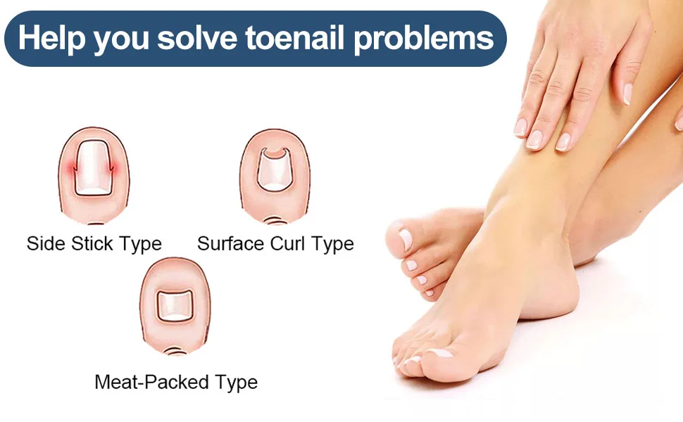 60 pcs toenail patch toenail correction patch ingrown toenails correction patch ingrown toenails pavement correction sticker toe nail 60pcs - product information 2