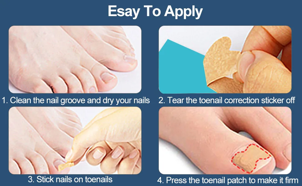 60 pcs toenail patch toenail correction patch ingrown toenails correction patch ingrown toenails pavement correction sticker toe nail 60pcs - product information 4