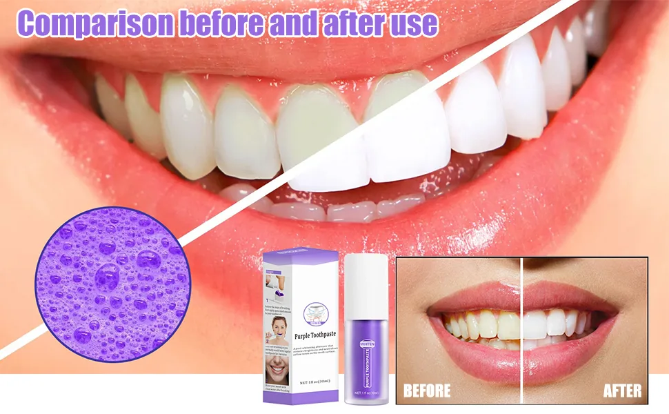 Purple Teeth Whitening Toothpaste toothpaste white teeth white teeth toothpaste tooth whitening bleaching purple purple toothpaste stain removal teeth deep stain removal coffee yellow teeth (1 Pack) - product information 4