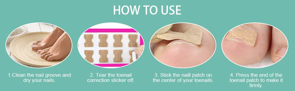Toenail patch ingrown toenail correction patch toenail correction patch toenail correction patch corrector pedicure tools correction sticker toe nail 60 pcs - product information 3