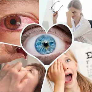 Fengyang 2PCs Eye drops treatment eye problems Solution drops eye drops against dry eyes eye problems solution drops relieves and treats wound effectively - used