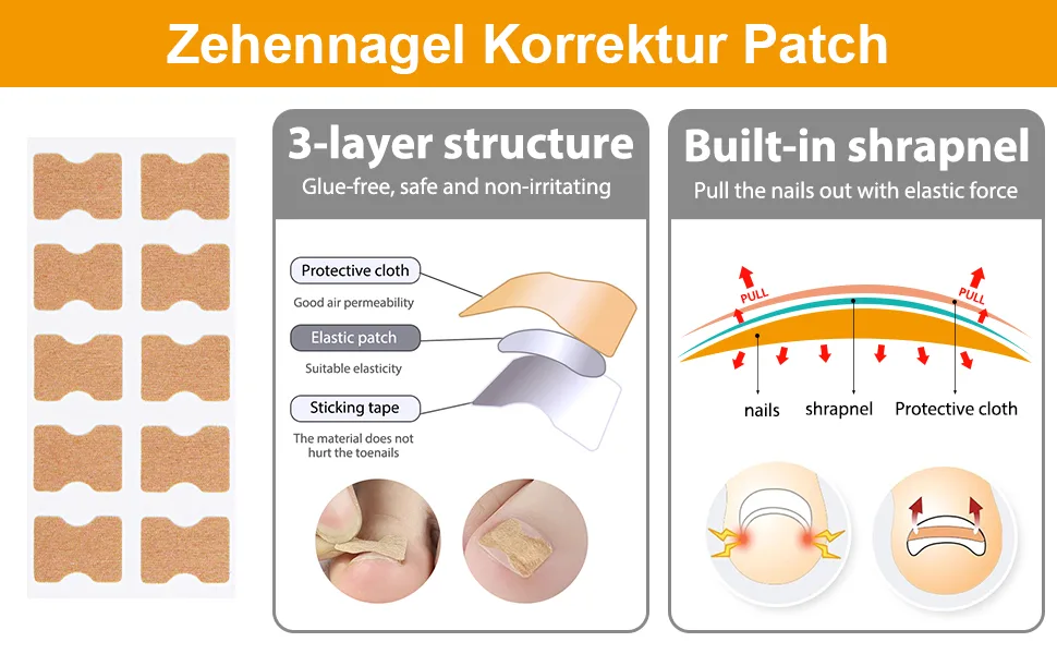 Tene nail patch 124 PCs ingrown toenail correction patch toenail correction patch corrector pedicure tools correction sticker toe nail pedicure set with 2 nail file ingrown toenail-5 - Eingewachsene Zehennägel Set