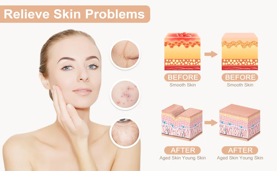 High Frequency Facial Machine - High Frequency Facial Wand, Device for Skin Care - product information 3