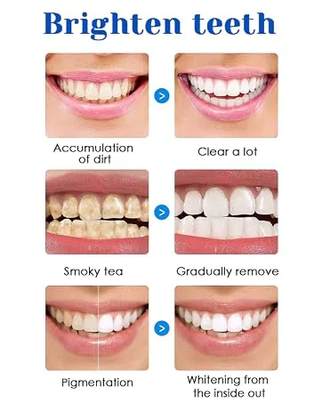 2 Pack Teeth Whitening Pen Teeth Whitening Pen Painless Teeth Bleaching for White Teeth White Teeth at Home - product information 5