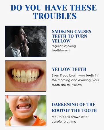 2 Pack Teeth Whitening Pen Teeth Whitening Pen Painless Teeth Bleaching for White Teeth White Teeth at Home - product information 6