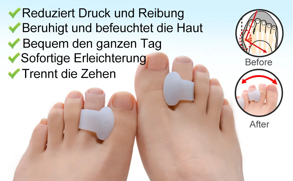 Welnove Toe Separators Gel Toe Spreaders Small Bunion Corrector to Prevent Friction and Relieve Pressure (12 Pack) Clear - product information 11