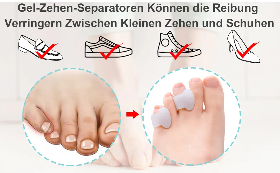 Welnove Toe Separators Gel Toe Spreaders Small Bunion Corrector to Prevent Friction and Relieve Pressure (12 Pack) Clear - product information 13