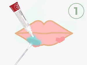 N1 Herpes cream for lip herpes with immediate effect 4 g - intensive cream - prevents blister stops the virus increase - open for 6 months. 2 ml (1 Pack) - n1 lippenherpes creme