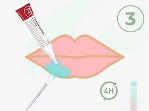 N1 Herpes cream for lip herpes with immediate effect 4 g - intensive cream - prevents blister stops the virus increase - open for 6 months. 2 ml (1 Pack) - n1 lippenherpes creme