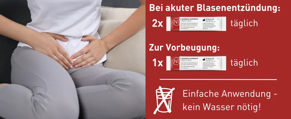 N1 D -Mannose Direktsticks 30 St. - For bladder infection and urinary tract infection - 30 days - without antibiotics - without water - easy taste 30 pieces (1 Pack) - n1 d-mannose