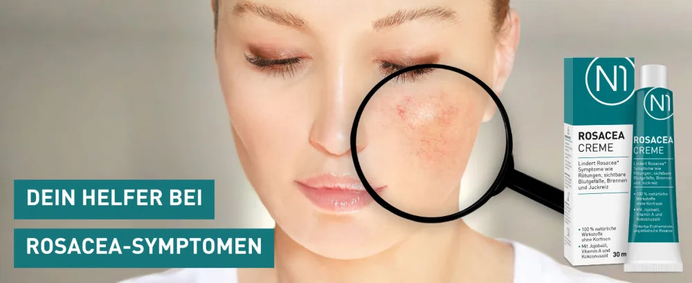N1 Rosacea cream 30 ml - medical device - reduces redness burning itching & visible blood vessels - 100% natural active ingredients without cortisone 30 ml (1 Pack) - n1 rosacea