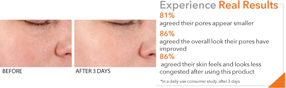 Dr. Dennis Gross Alpha Beta® Pore Perfecting & Refining Serum: for Enlarged, Clogged Pores with Excessive Oil, 1.0 fl oz - product information 3